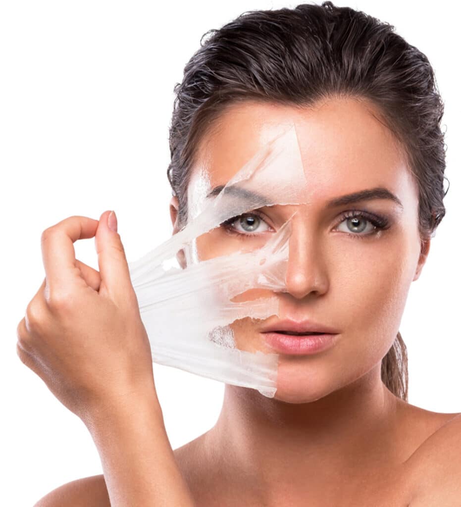 Chemical Peels Easton Maryland